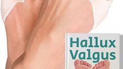 Miglior fascia per alluce valgo